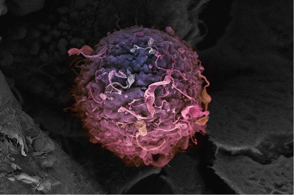 Tế bào ung thư đối phó với hệ thống miễn dịch như thế nào?